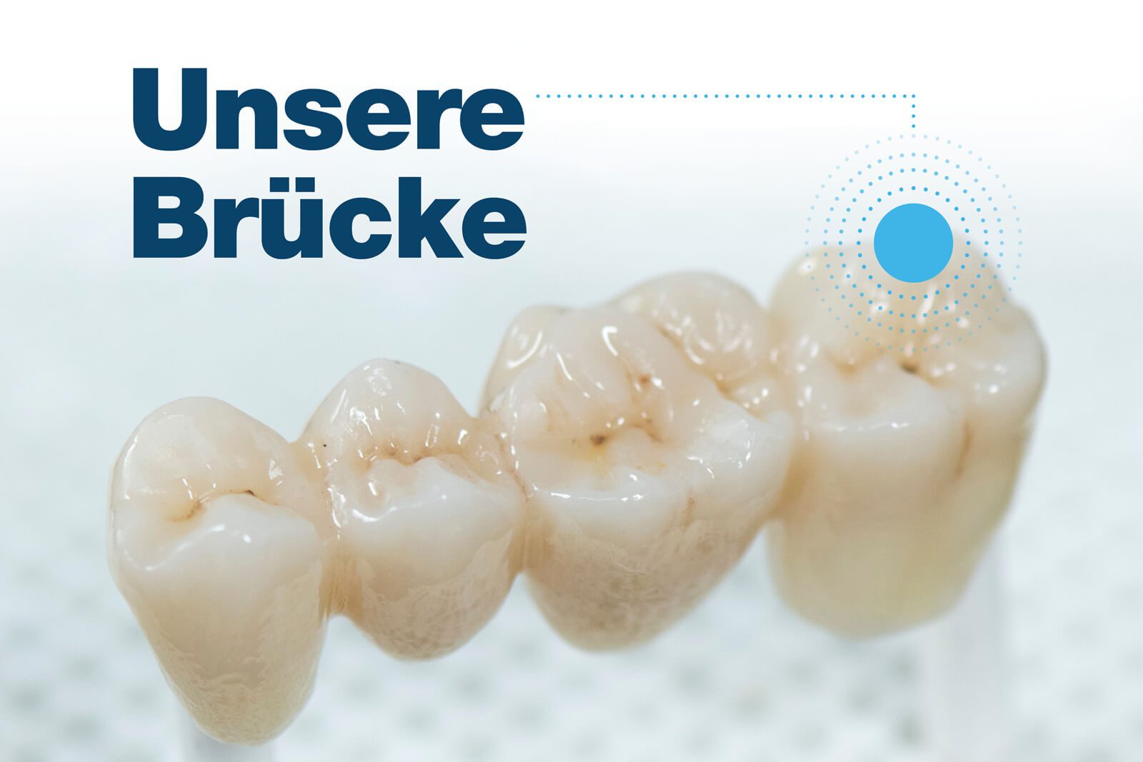 Dentaltechnik Marcel Schrod – News – Unsere Brücke Dentaltechnik Marcel Schrod - News - Unsere Brücke